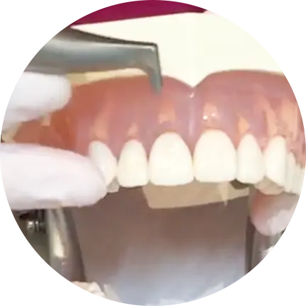 治療した歯のメインテナンス