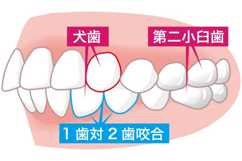 理想の咬み合わせのイラスト