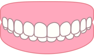 過蓋咬合のイラスト